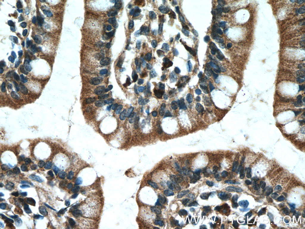 IHC staining of human small intestine using 10026-1-AP