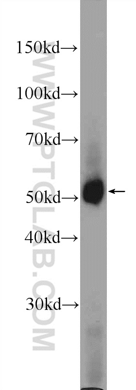 WB analysis of mouse liver using 10026-1-AP