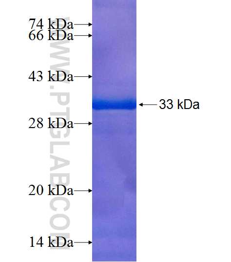 PDK2 fusion protein Ag8206 SDS-PAGE