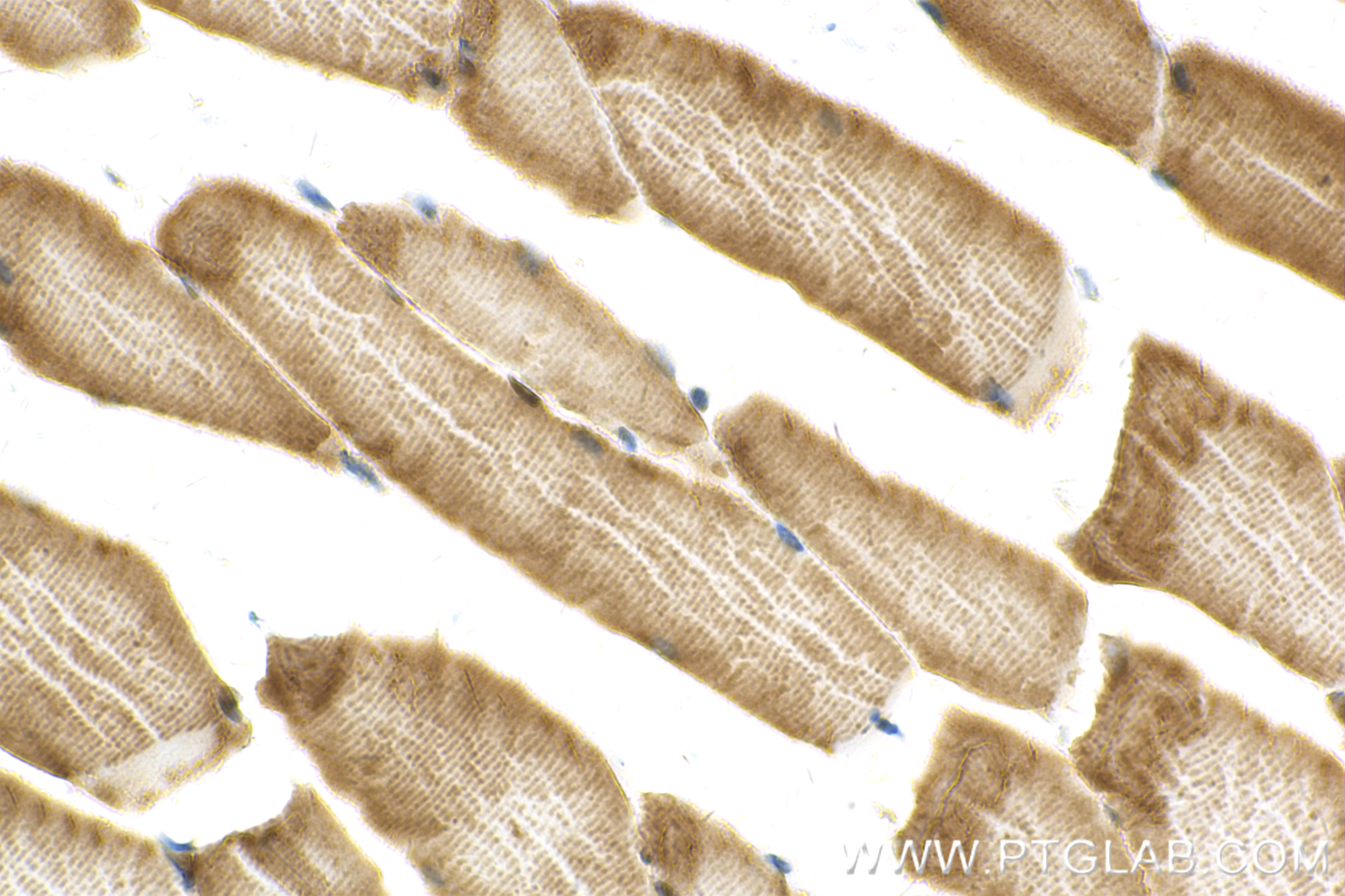 IHC staining of mouse skeletal muscle using 83583-1-RR (same clone as 83583-1-PBS)