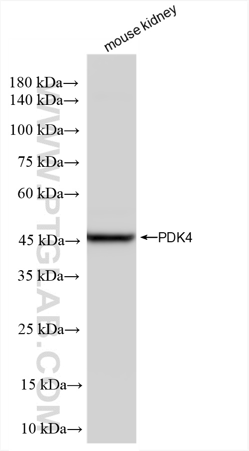 WB analysis of mouse kidney using 83583-1-RR (same clone as 83583-1-PBS)