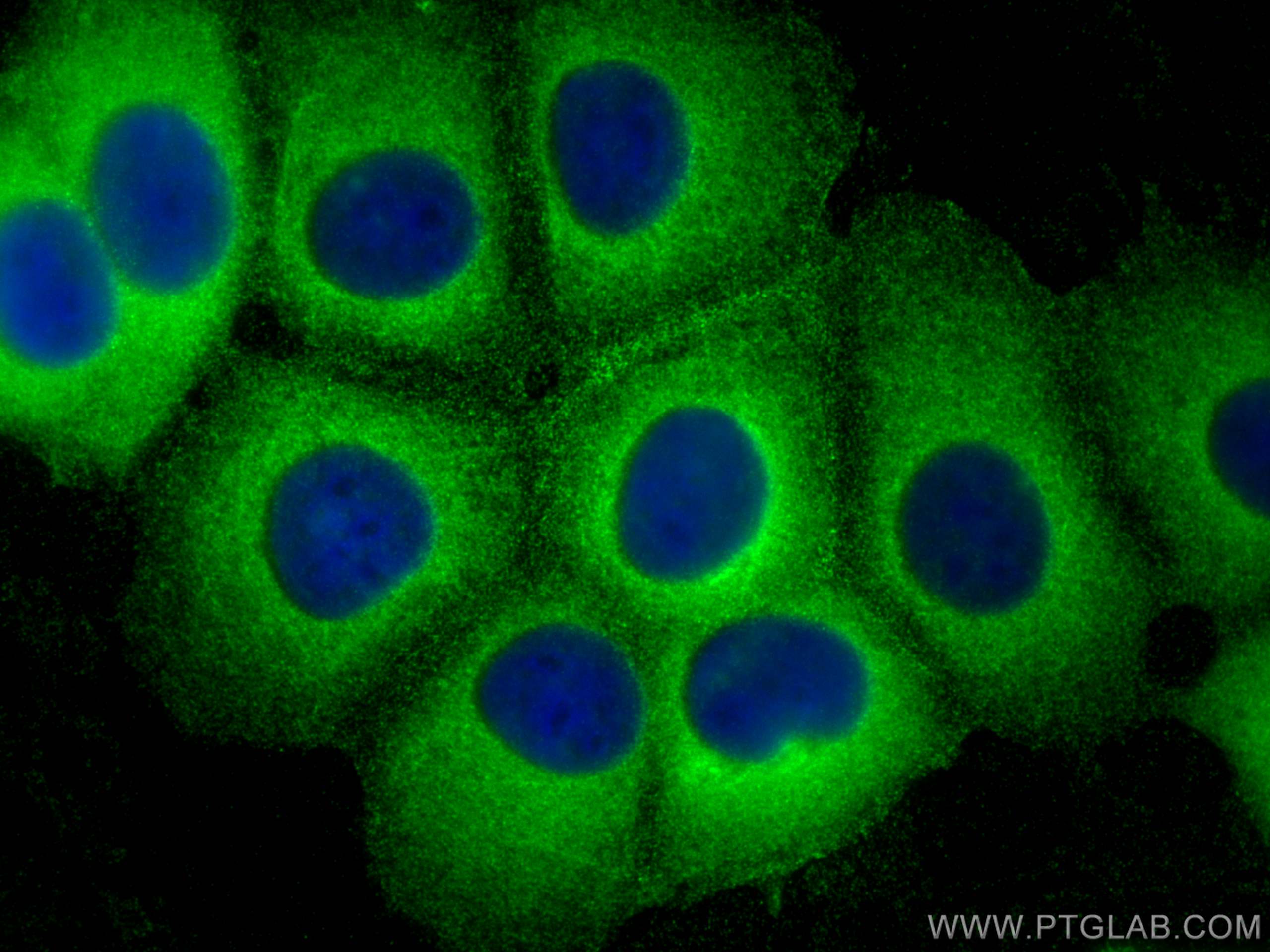 IF Staining of MCF-7 using 11674-1-AP