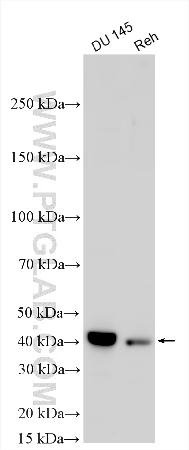 WB analysis using 11574-1-AP WB analysis using 11574-1-AP