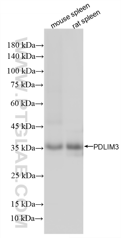 WB analysis using 87058-2-RR (same clone as 87058-2-PBS)