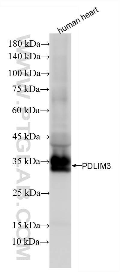 WB analysis of human heart using 87058-2-RR (same clone as 87058-2-PBS)
