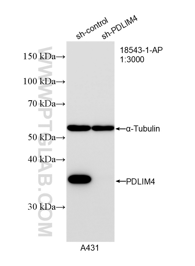 WB analysis of A431 using 18543-1-AP