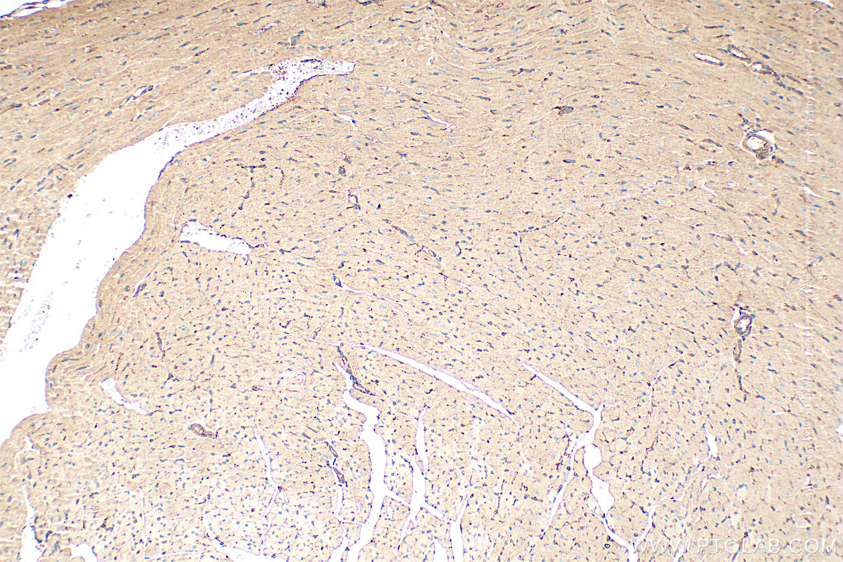 Immunohistochemical analysis of paraffin-embedded mouse heart tissue slide using 10530-1-AP (PDLIM5 antibody) at dilution of 1:400 (under 10x lens). Heat mediated antigen retrieval with Tris-EDTA buffer (pH 9.0). IHC staining of mouse heart using 10530-1-AP