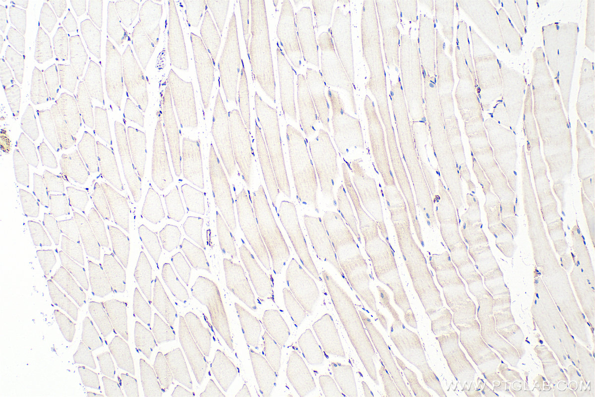 Immunohistochemical analysis of paraffin-embedded mouse skeletal muscle tissue slide using 10530-1-AP (PDLIM5 antibody) at dilution of 1:400 (under 10x lens). Heat mediated antigen retrieval with Tris-EDTA buffer (pH 9.0). IHC staining of mouse skeletal muscle using 10530-1-AP