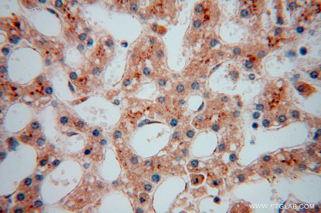 IHC staining of human liver using 17080-1-AP