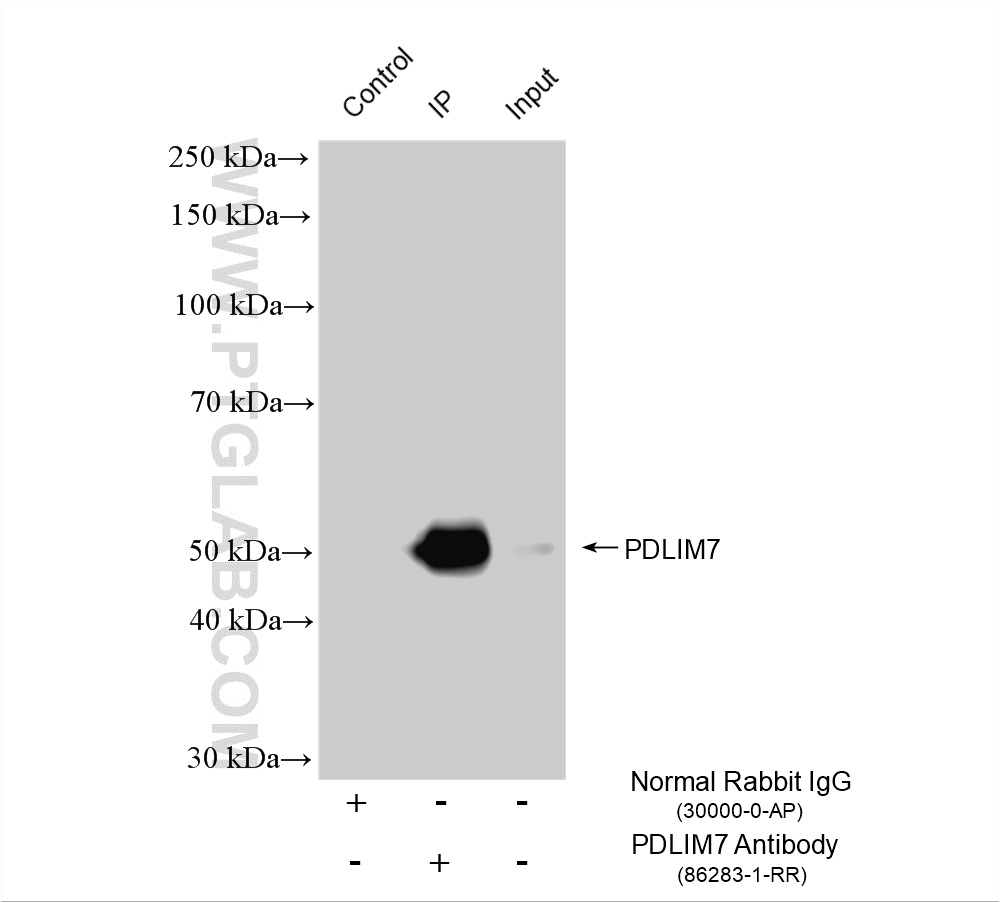 IP experiment of HeLa using 86283-1-RR IP experiment of HeLa using 86283-1-RR