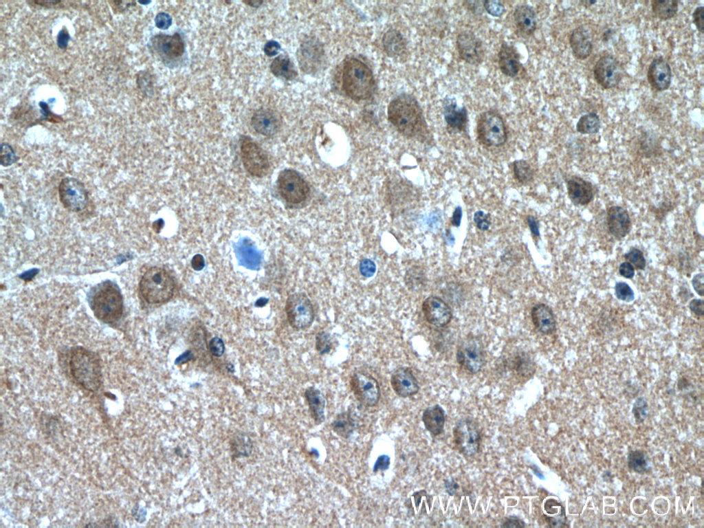 IHC staining of mouse brain using 13404-1-AP