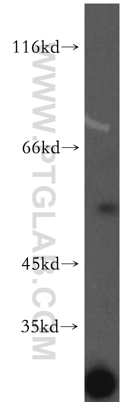 WB analysis of mouse skeletal muscle using 13404-1-AP