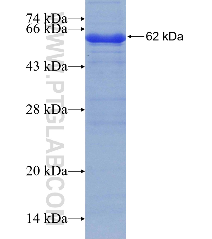 PDP2 fusion protein Ag4257 SDS-PAGE