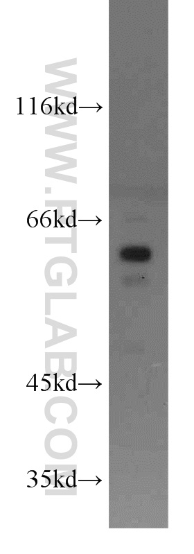 PDPK1 Polyclonal antibody