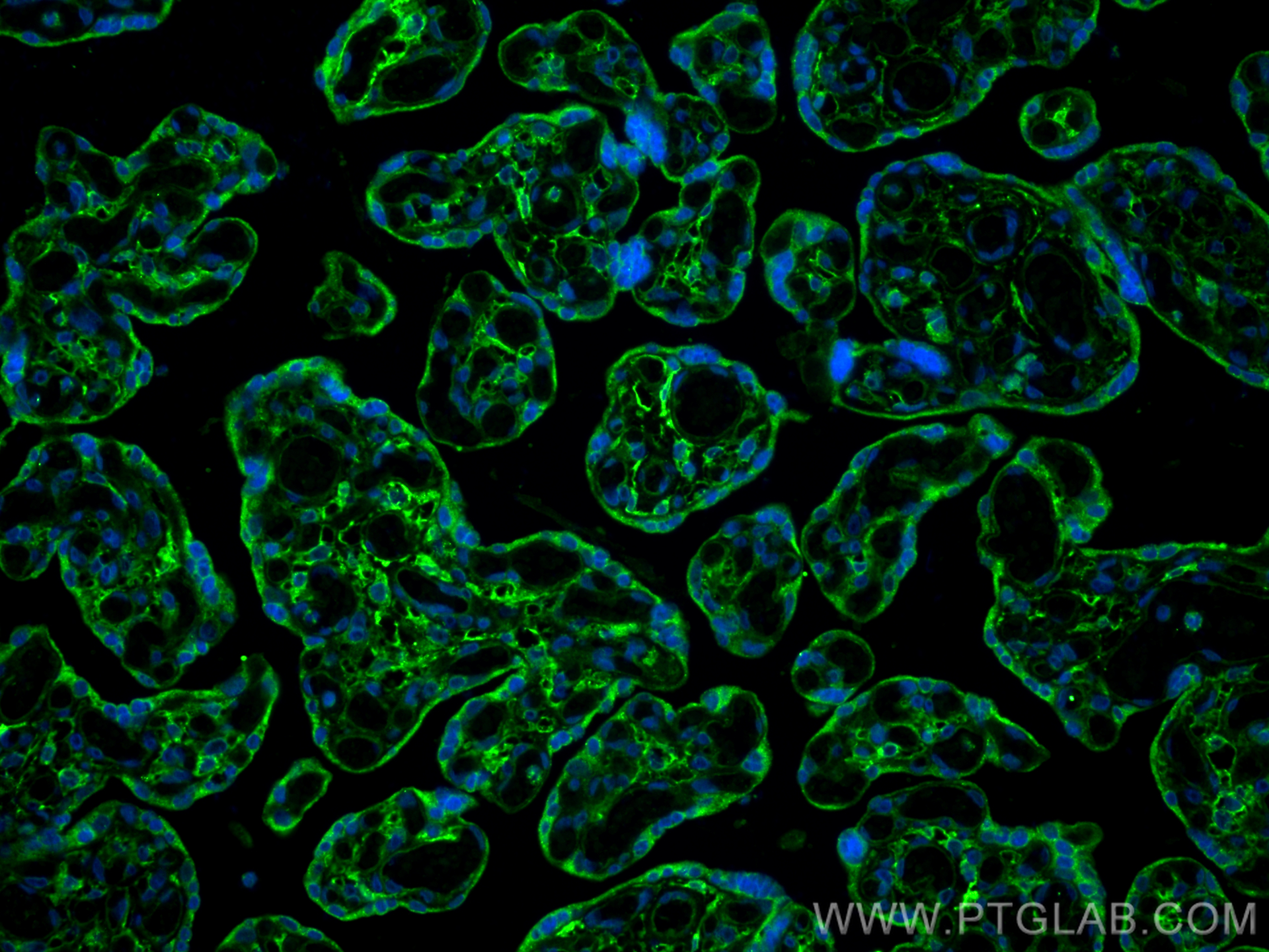 IF Staining of human placenta using 22099-1-AP