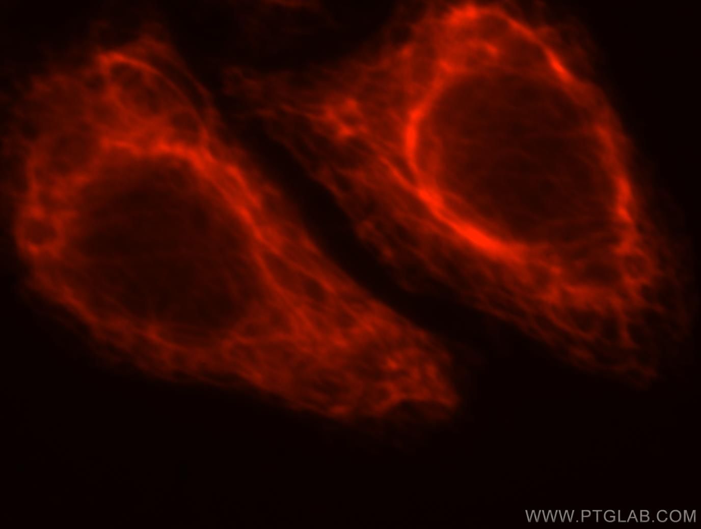 IF Staining of HepG2 using 16968-1-AP