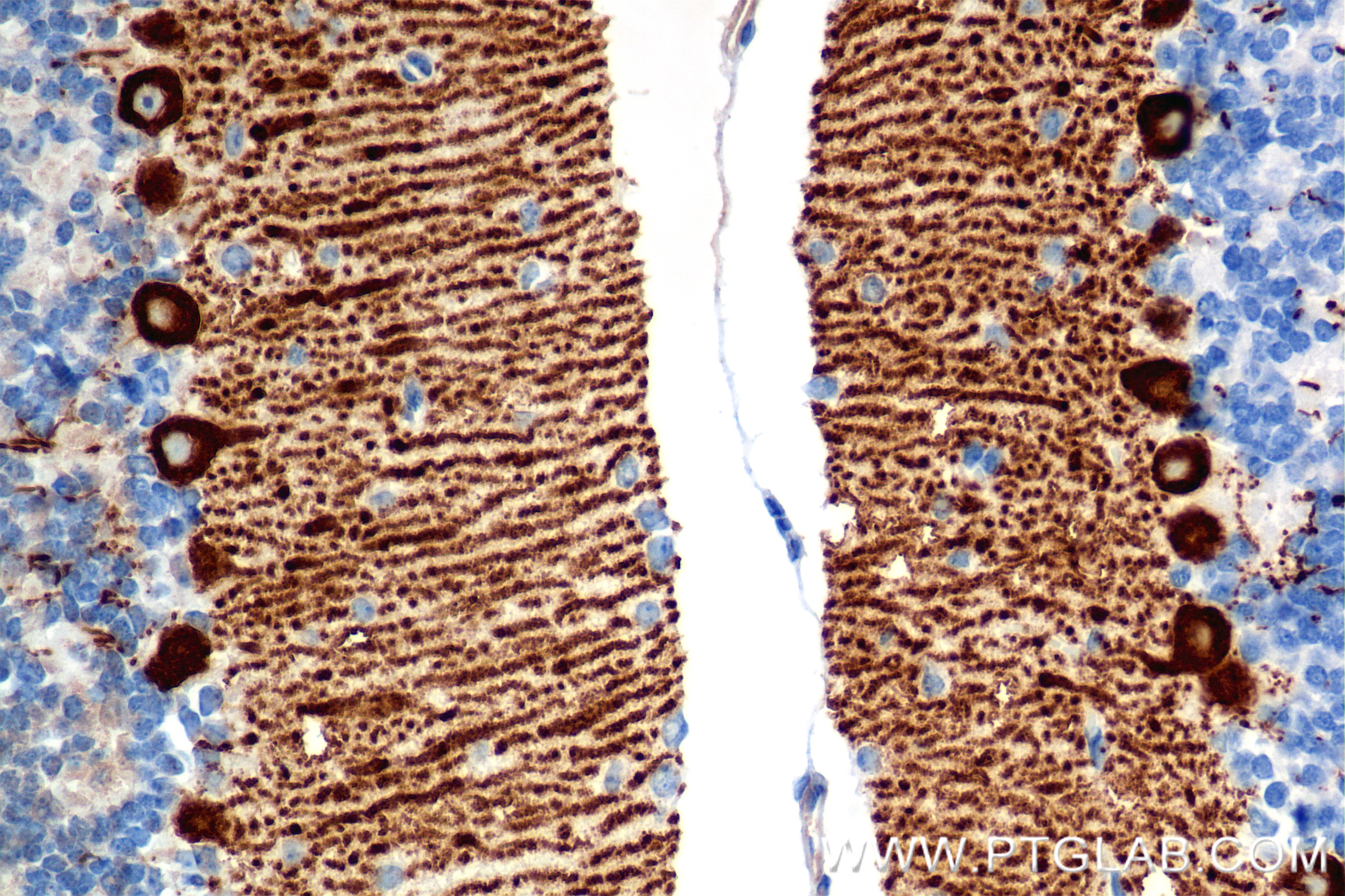 IHC staining of mouse cerebellum using 85851-4-RR (same clone as 85851-4-PBS)