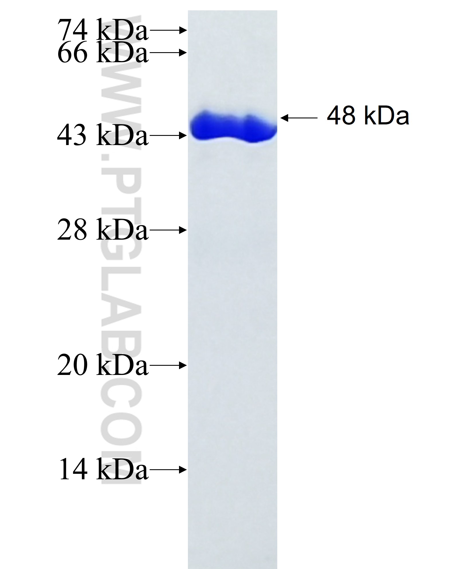 PDS5B fusion protein Ag27977 SDS-PAGE