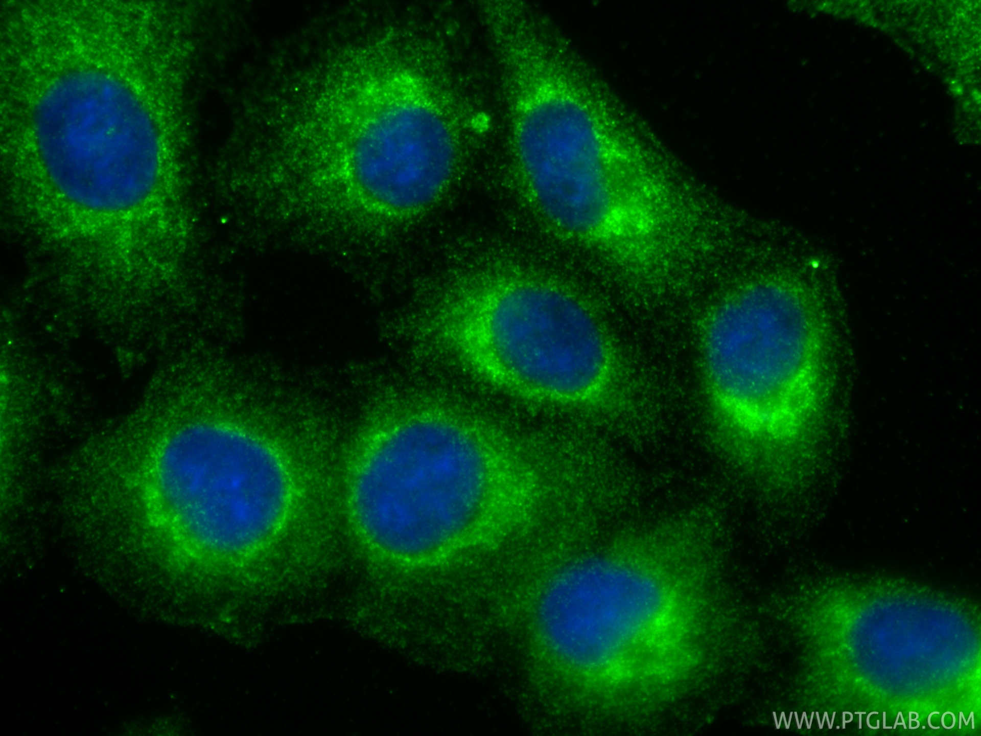 IF Staining of A549 using 33109-1-AP (same clone as 33109-1-PBS) IF Staining of A549 using 33109-1-AP (same clone as 33109-1-PBS)