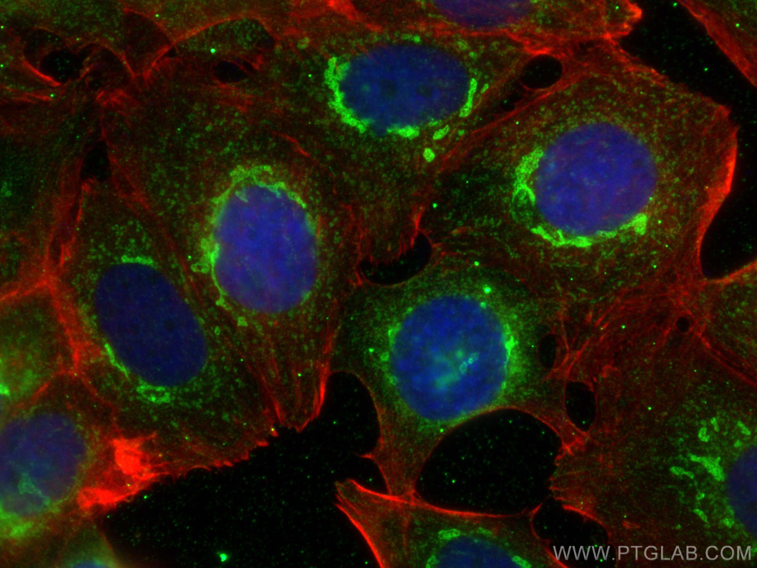 IF Staining of MCF-7 using 68278-1-Ig