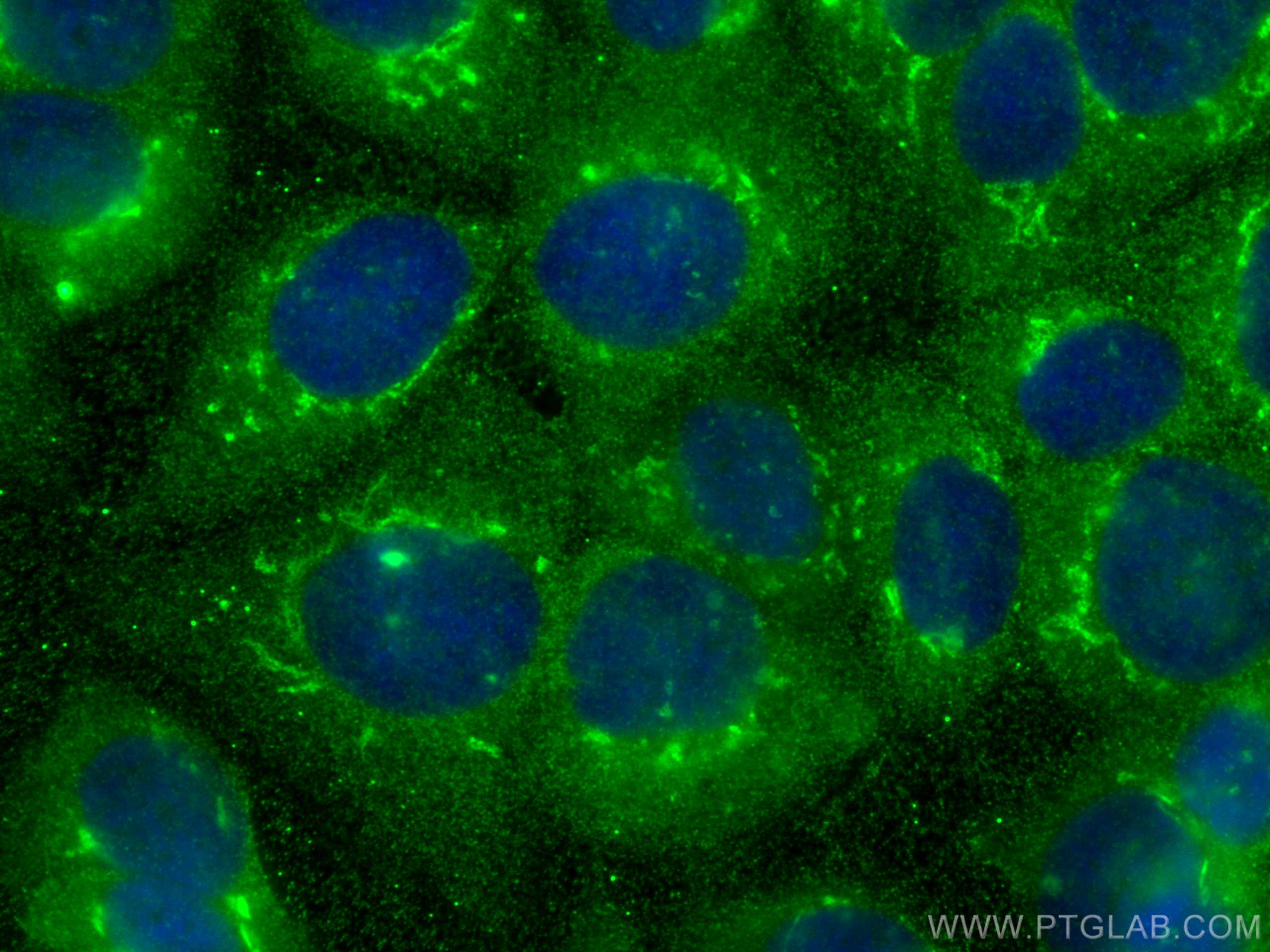 IF Staining of MCF-7 using 68278-1-Ig