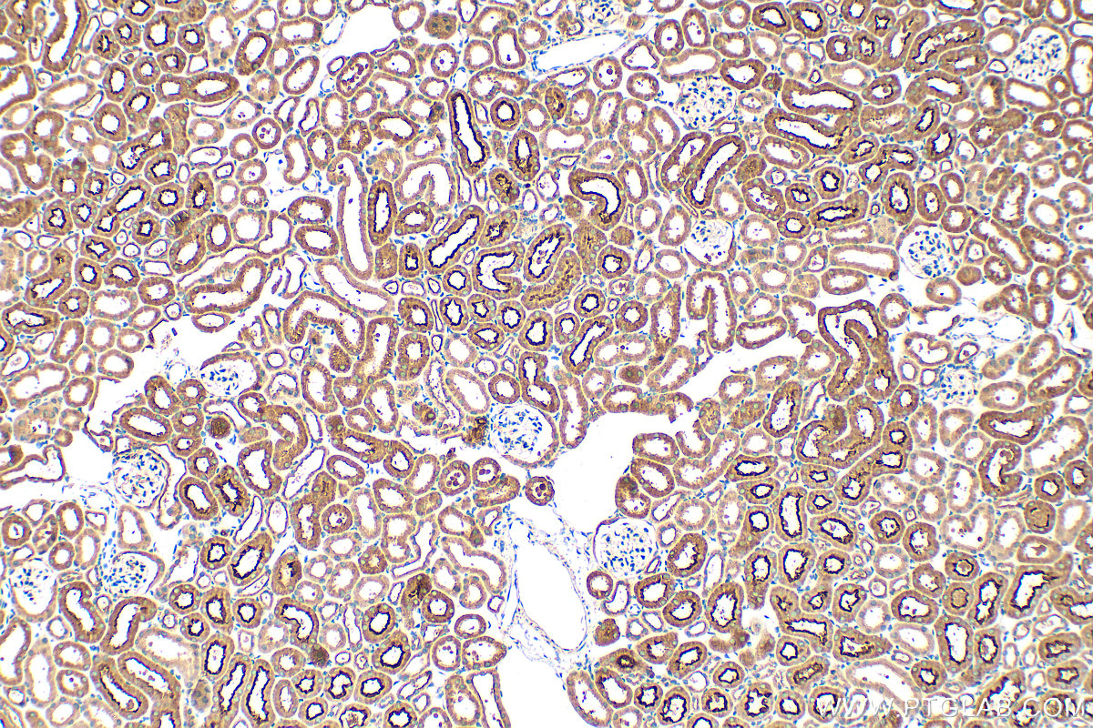 Immunohistochemical analysis of paraffin-embedded mouse kidney tissue slide using 26236-1-AP (PDZD11 antibody) at dilution of 1:200 (under 10x lens). Heat mediated antigen retrieval with Tris-EDTA buffer (pH 9.0). IHC staining of mouse kidney using 26236-1-AP
