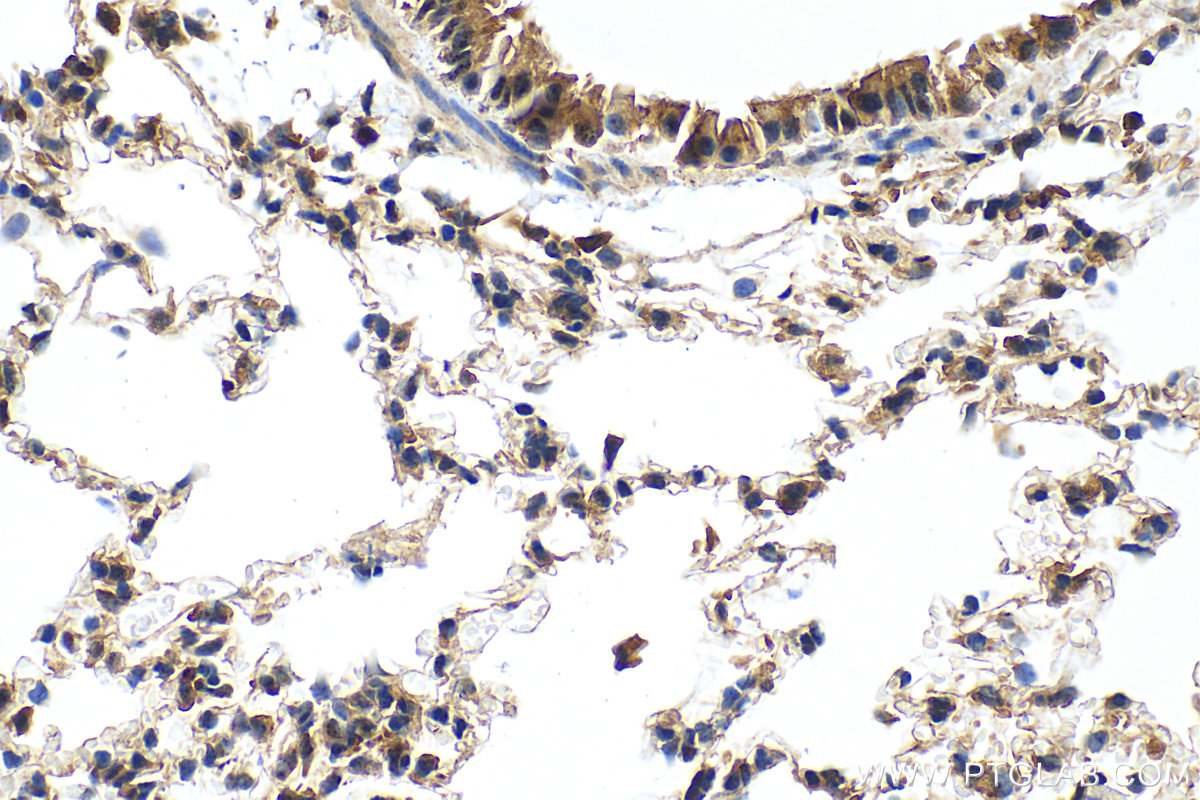 IHC staining of mouse lung using 30191-1-AP
