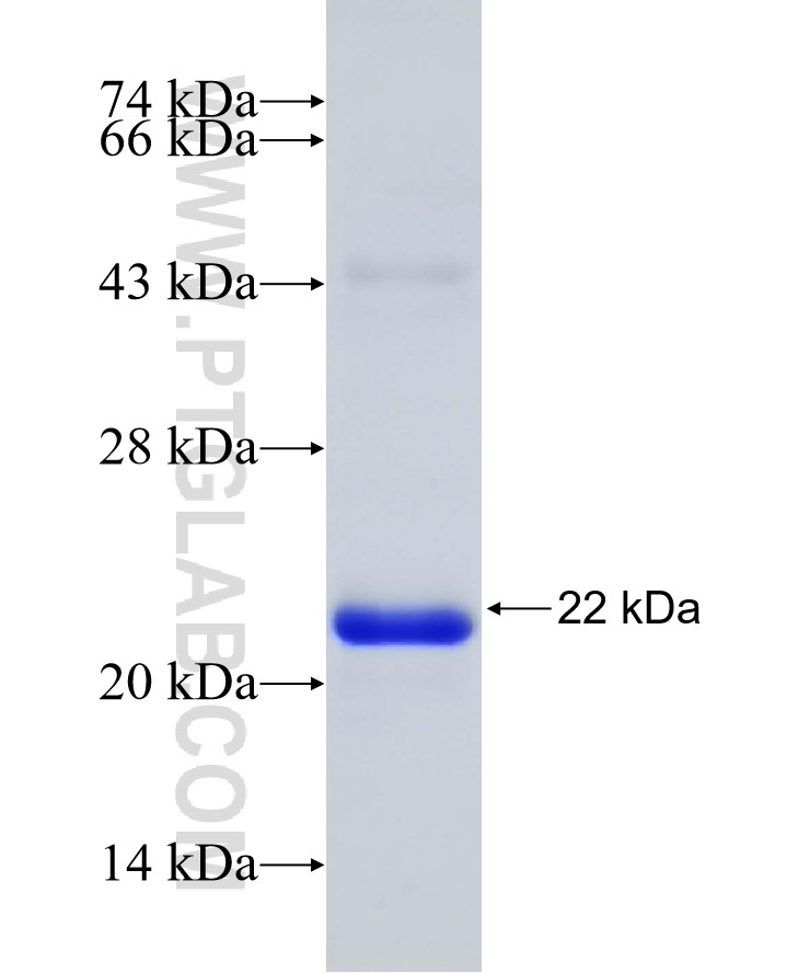 PDZD2 fusion protein Ag31602 SDS-PAGE