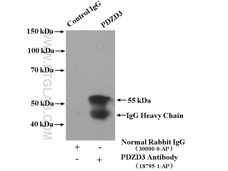 IP experiment of mouse kidney using 18795-1-AP
