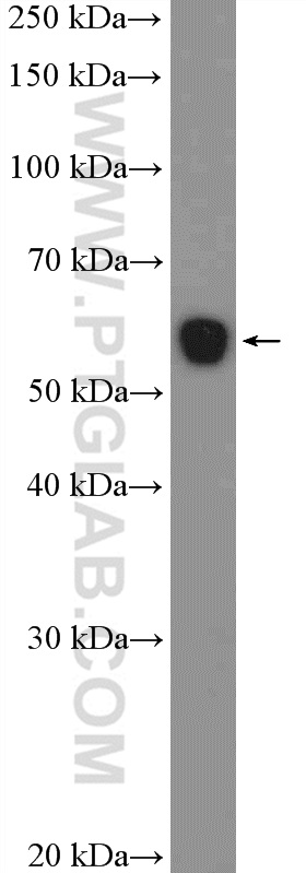 WB analysis of rat kidney using 18795-1-AP