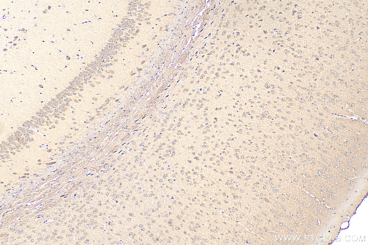 IHC staining of mouse brain using 20167-1-AP