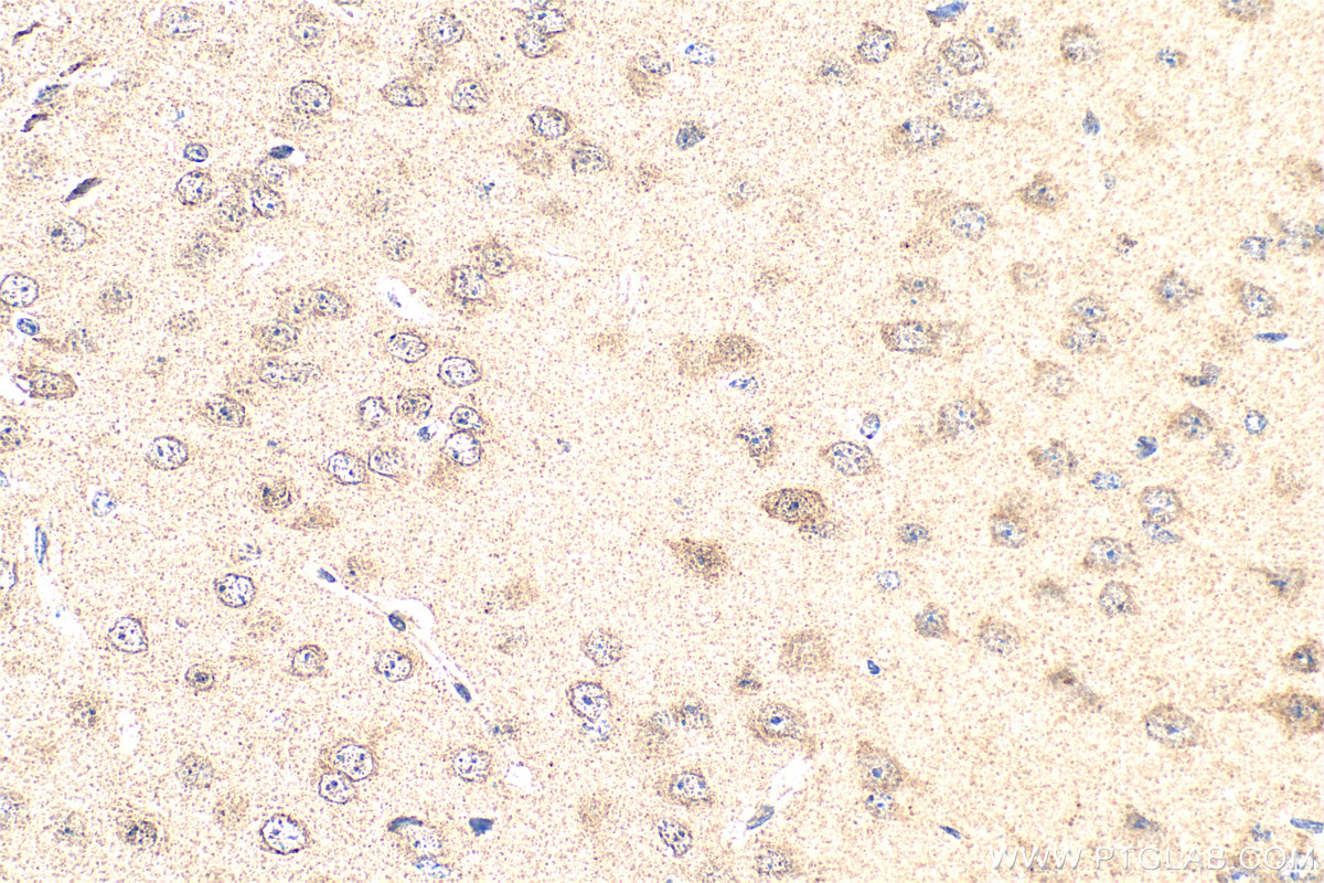 IHC staining of mouse brain using 20167-1-AP