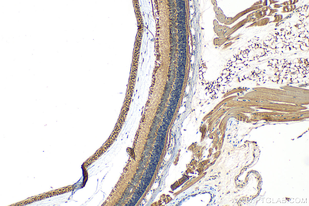 IHC staining of mouse eye using 21084-1-AP