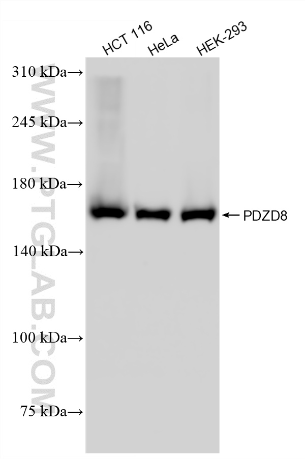 WB analysis using 87134-1-RR (same clone as 87134-1-PBS)