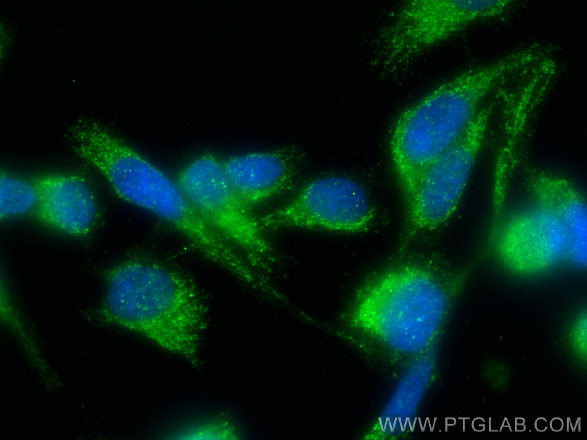 IF Staining of PC-3 using 12518-1-AP