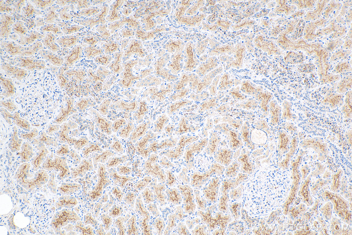 IHC staining of human kidney using 12518-1-AP