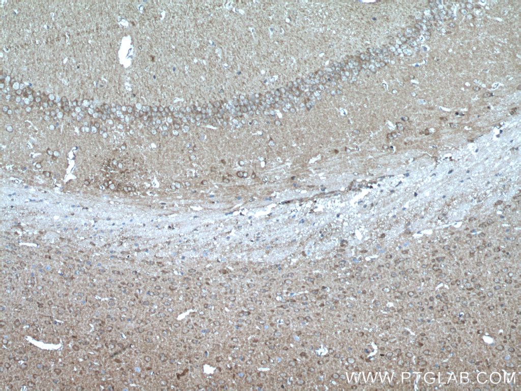 IHC staining of mouse brain using 21446-1-AP