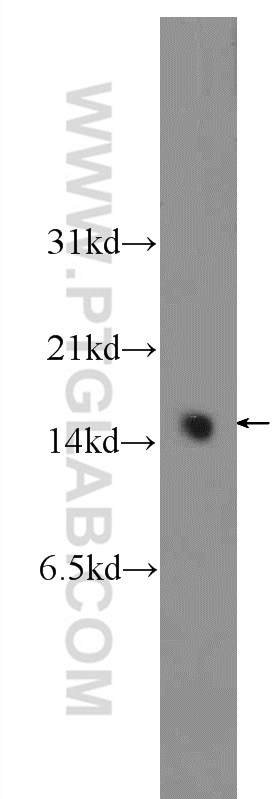 WB analysis of fetal human brain using 21446-1-AP