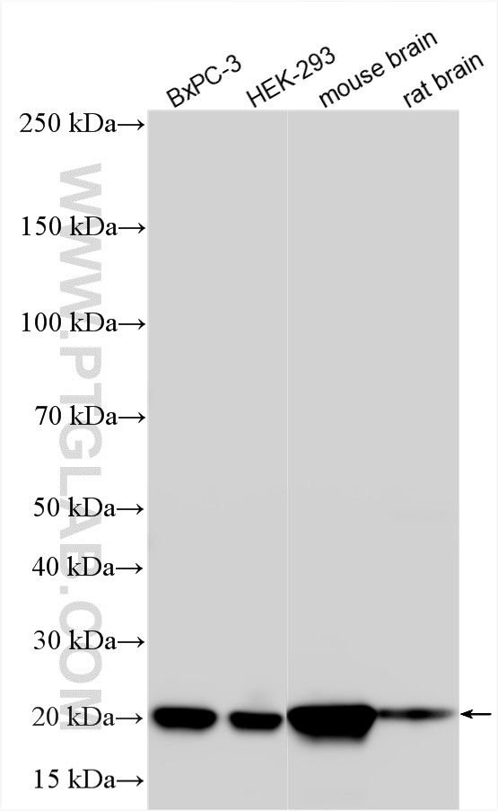 WB analysis using 10575-1-AP WB analysis using 10575-1-AP