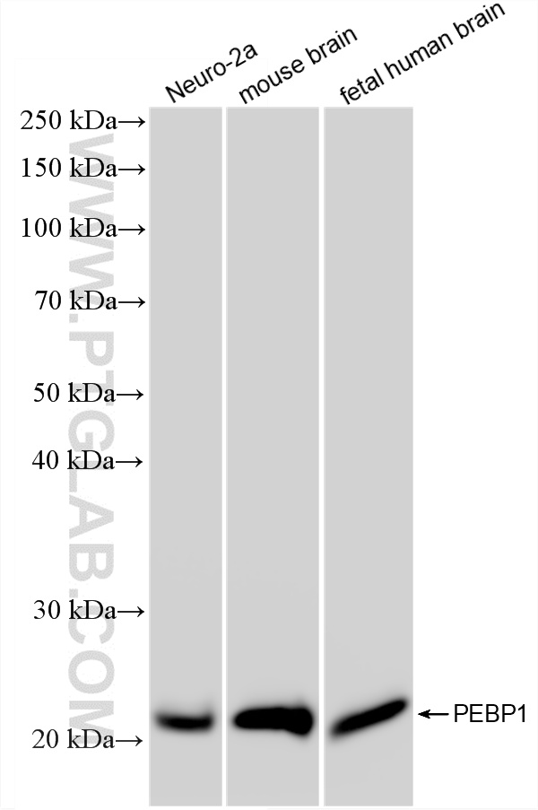 WB analysis using 88106-1-RR WB analysis using 88106-1-RR