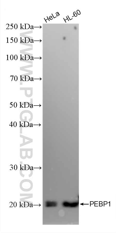WB analysis using 88106-1-RR WB analysis using 88106-1-RR