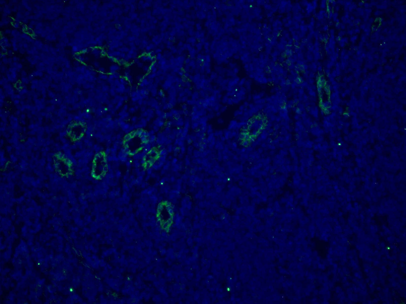 IF Staining of human tonsillitis using 66065-1-Ig