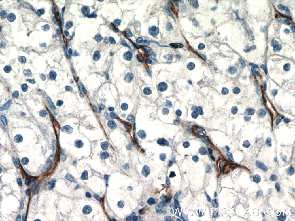 CD31 Polyclonal antibody