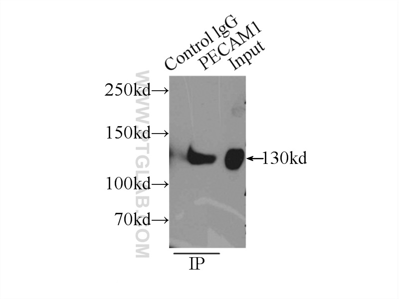 IP experiment of Jurkat using 11265-1-AP