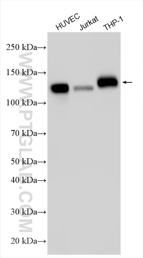 WB analysis using 11265-1-AP