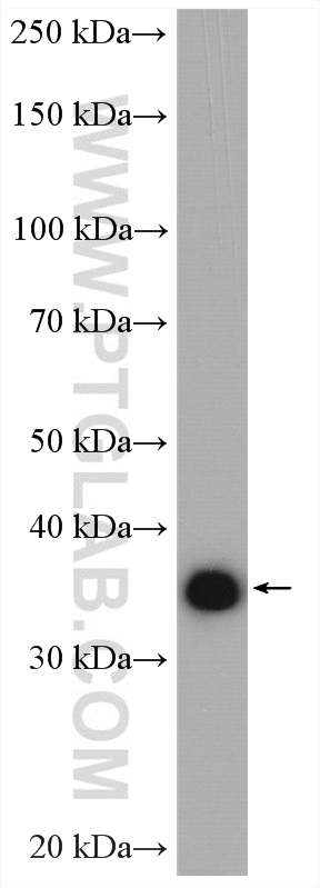 WB analysis of human placenta using 20383-1-AP