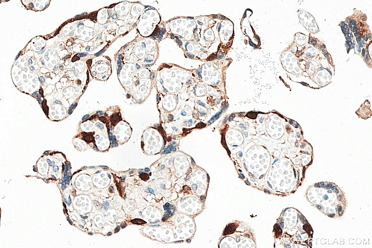 IHC staining of human placenta using 14412-1-AP