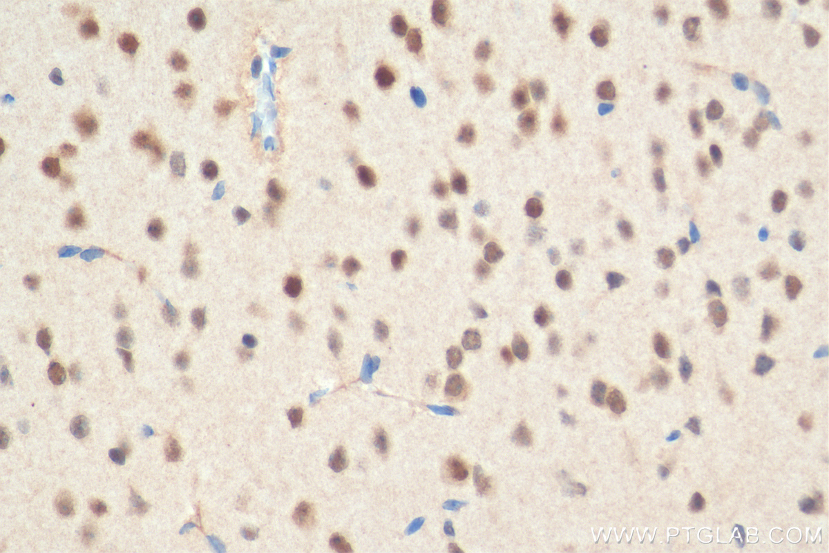 IHC staining of mouse brain using 23569-1-AP