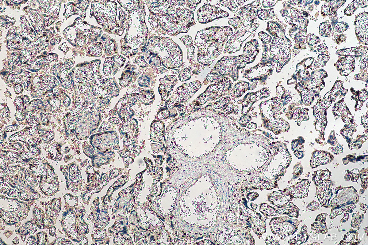 IHC staining of human placenta using 23569-1-AP