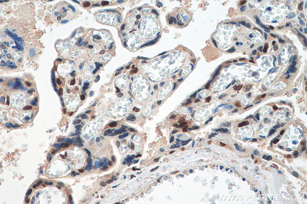 IHC staining of human placenta using 23569-1-AP